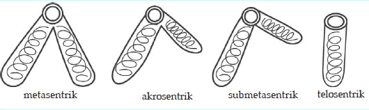 bentuk kromosom berdasarkan letak sentromer