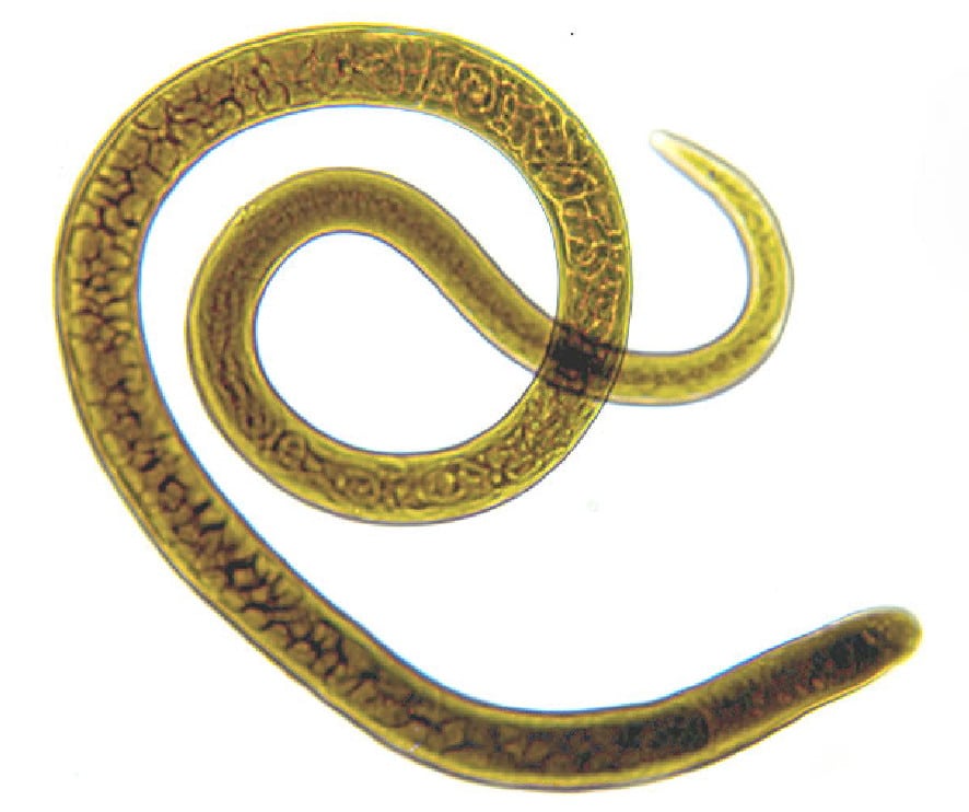 nemathelminthes contoh hewan pinwormok, amelyek