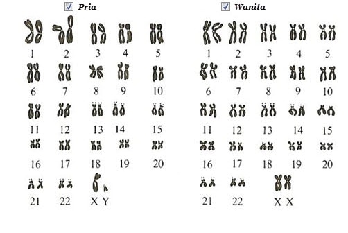 susunan kromosom disebut kariotipe